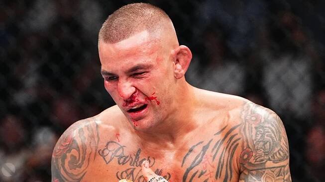 Dustin Poirier Says He Suffered Broken Nose, Rib During UFC 302 Fight
