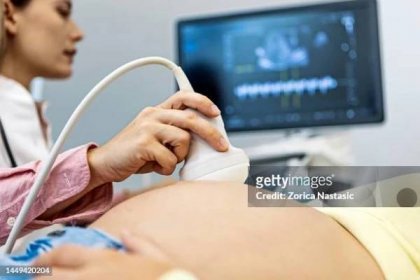 doctor with a pregnant woman - pelvic exam stock pictures, royalty-free photos & images