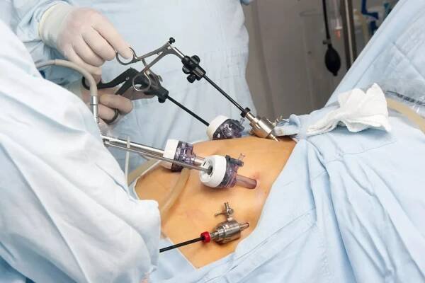 bariatric-surgery2 (1)