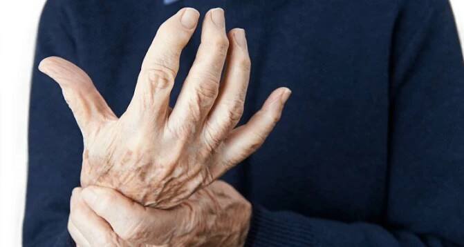 Revmatoidní artritida: Příznaky, příčiny a zaručená léčba