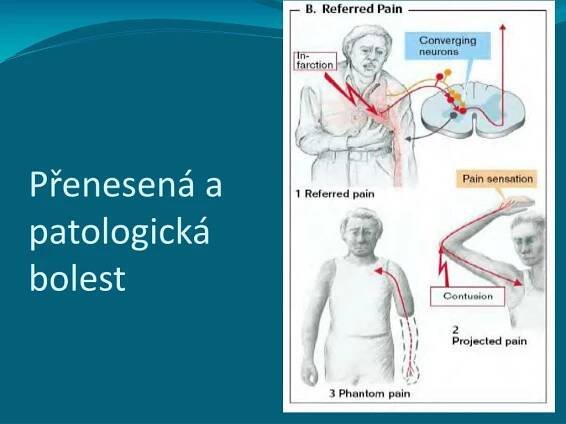 PPT - Patofyziologie NS PowerPoint Presentation, free download - ID:4598881