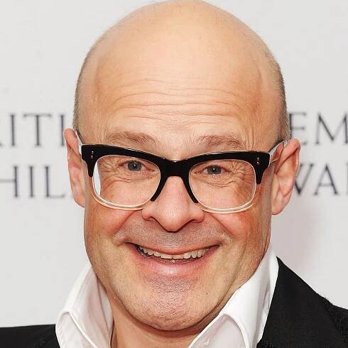 Harry-Hill-Famous-Bald-Men