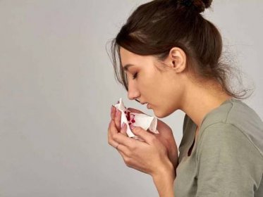 Jak zastavit krvácení z nosu - účinné metody a tipy