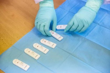 Praktičtí lékaři otestují antigenními testy na covid-19 patrně jen své registrované pacienty