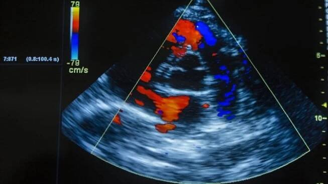Ultrazvuková náplast vyšetřuje i léčí. Vědci pracují na dalším zdokonalení