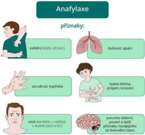 Příznaky anafylaxe