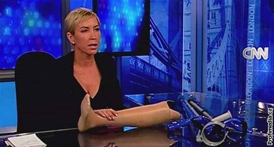 Heather Millsová ukazuje svou protézu