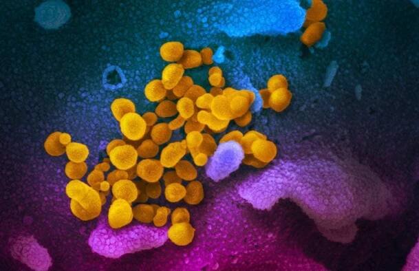  Novel Coronavirus SARS-CoV-2