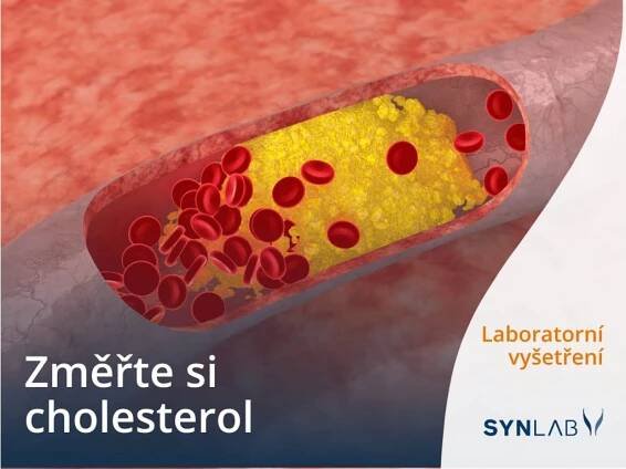 Preventivní laboratorní balíčky