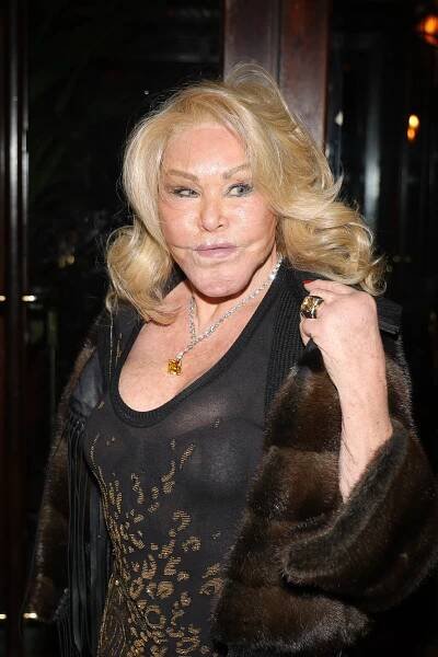 I haven’t had plastic surgery & hate Botox, says ‘Catwoman’ Jocelyne Wildenstein during shock claim about appearance | The