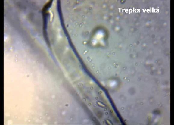 TREPKA VELKÁ