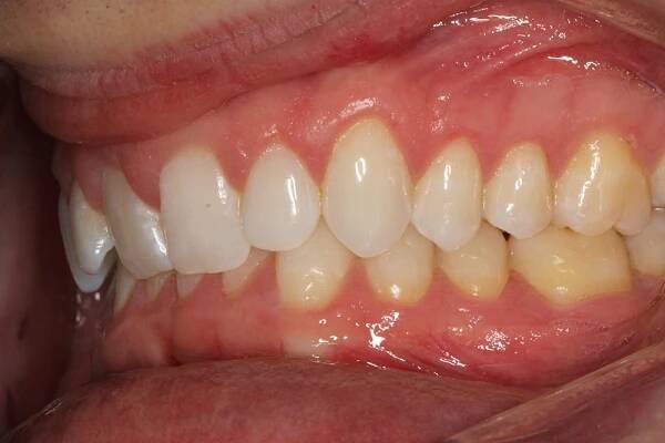 Before and After • 425 Dental