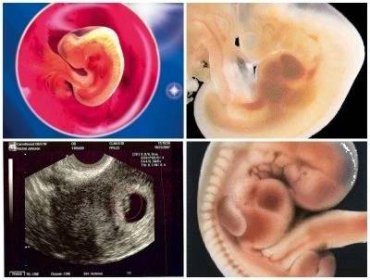Ultrazvuk ve 4. týdnu těhotenství (26 fotografií): velikost plodu, je možné provést ultrazvuk v 3-4 týdnech, jak je možné