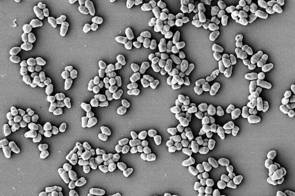 Vyrobte biologicky rozložitelný plast počínaje bakterií