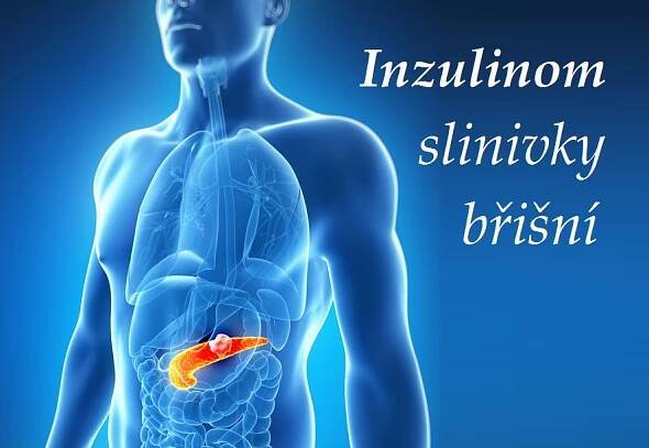 Inzulinom, insulinom (nádor tvořící inzulín) - příznaky, projevy, symptomy