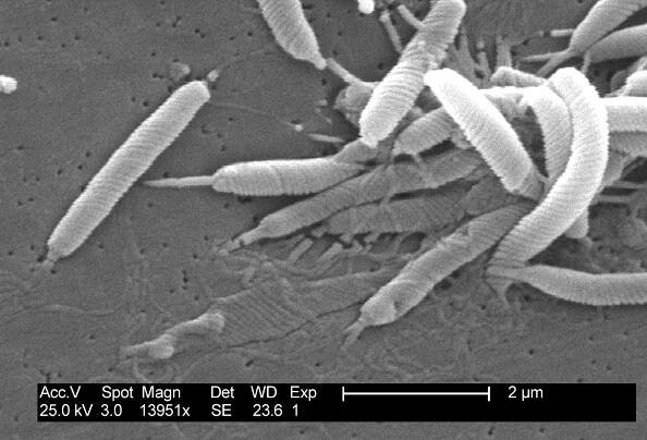 Helicobacter cinaedi