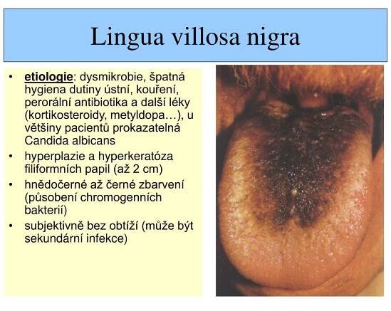 PPT - Patologie jazyka PowerPoint Presentation, free download - ID:711828
