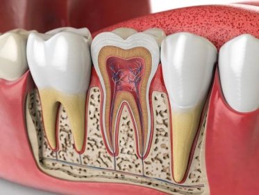 Jak doma zacházet se zubním kazem a předejít nesnesitelné bolesti? Přípravky z lékárny nejsou nutné