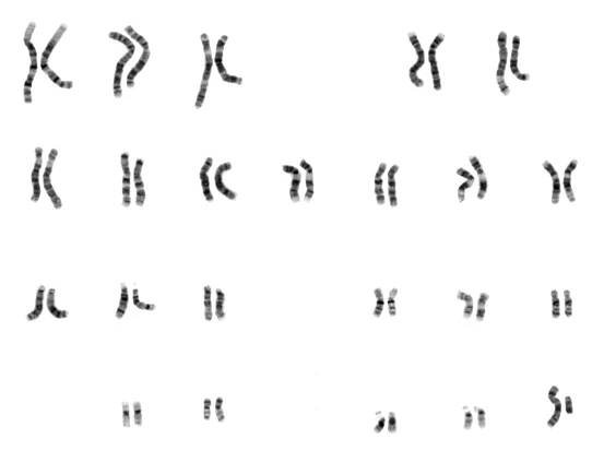 Karyotyp