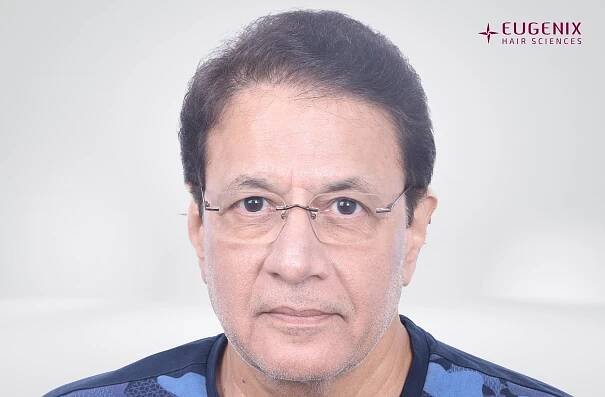 Arun Govil Front After