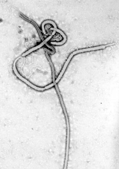 Krvácivá (hemoragická) horečka Ebola : Biologické zbraně