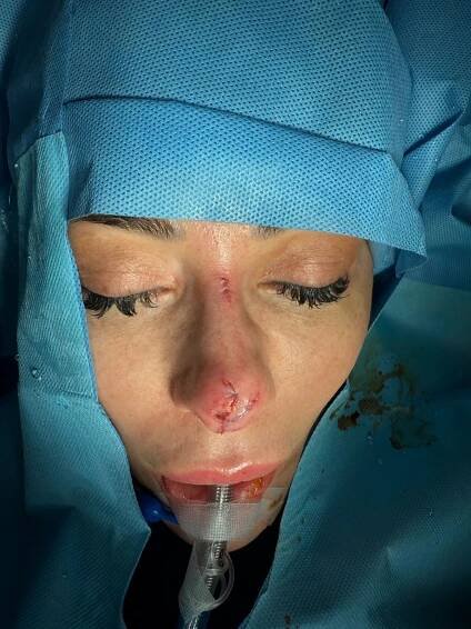 Influencer Ju Isen spent over $40,000 restoring her face after a dog bite at a party left her scarred and traumatized, undergoing surgeries and advanced aesthetic treatments.