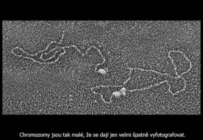Chromozomy jsou tak malé, že se dají jen velmi špatně vyfotografovat.