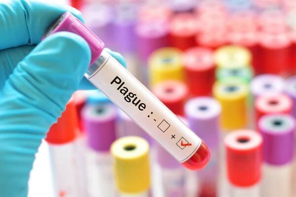 Rozumíte svému lékaři? Co znamená, když se řekne „glykovaný hemoglobin“