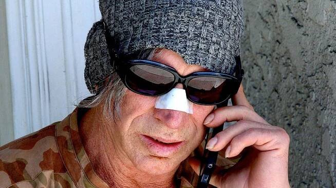 Mickey Rourke je závislý na plastikách: Nechal si znovu upravit nos! - Super.cz