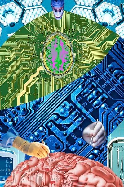 Your Next Job: Brain-Computer Interface Surgeon