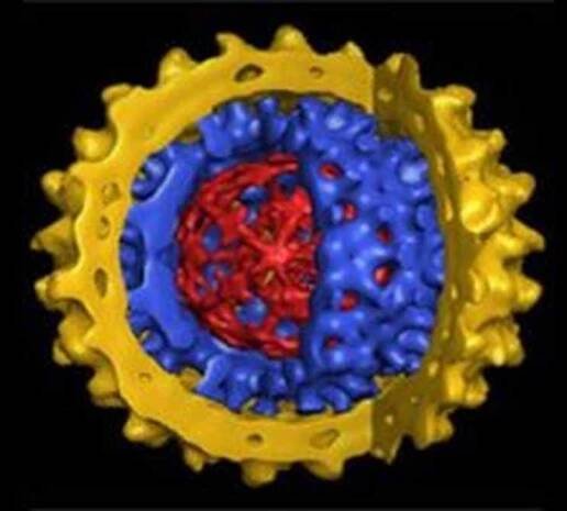 Virové hepatitidy E / Hepatitida