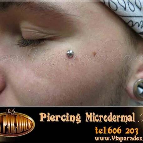 Microdermal - Via Paradox