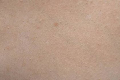 Fotografie zdravé lidské kůže, makrofotografování — Stock obrázek