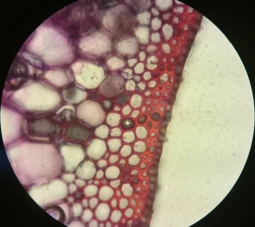 Hellfeldmikroskopie