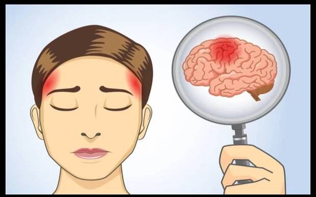What Is a Brain Tumor? - Types, Treatment, Symptoms