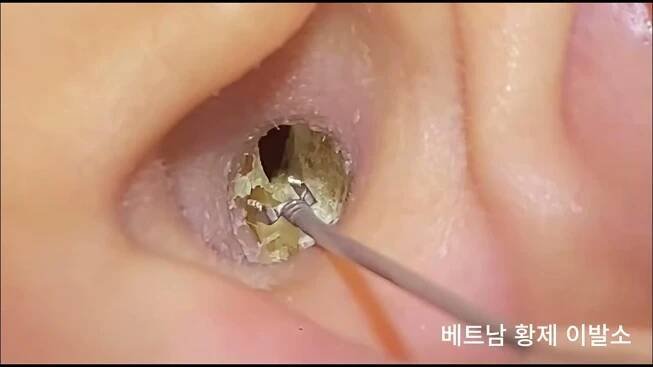 극강의 귀 청소 ASMR 모음집