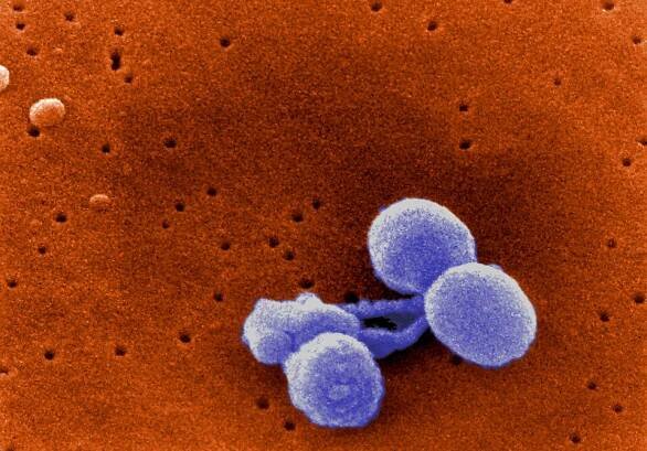 What causes pneumonia?