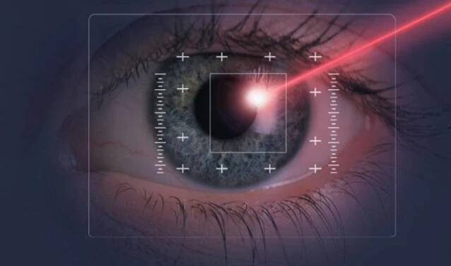 Laserové operace očních vad