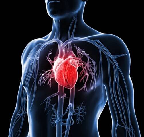 aneuryzma srdca