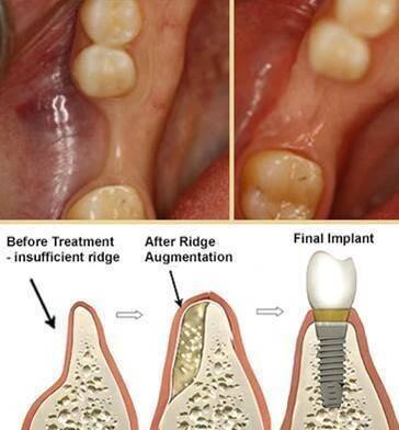 insufientridge