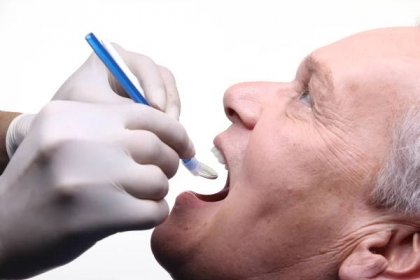 Rakovina ústní dutiny: Toto jsou první příznaky