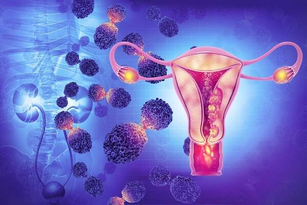 nemoci ženského reprodukčního systému. rakovina dělohy a endometriální maligní nádor jako děložní lékařský koncept. 3d ilustrace - ženská rozmnožovací soustava - stock snímky, obrázky a fotky