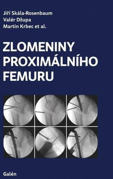 Zlomeniny proximálního femuru - Jiří Skála-Rosenbaum a kol. (2019, pevná bez přebalu)