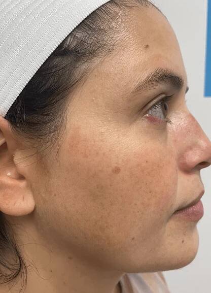 Top-Rated Cosmetic Dermatology Experts - Mandel Dermatology 