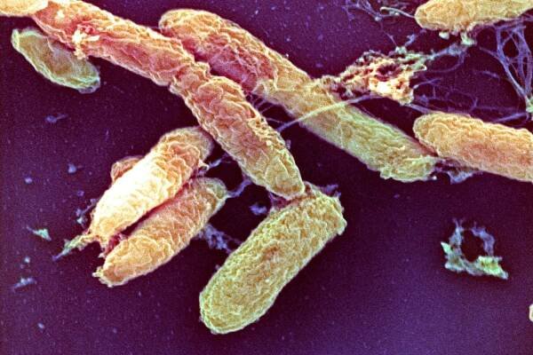 Patient dies from 'Black Death' plague less than 24 hours after symptoms emerged