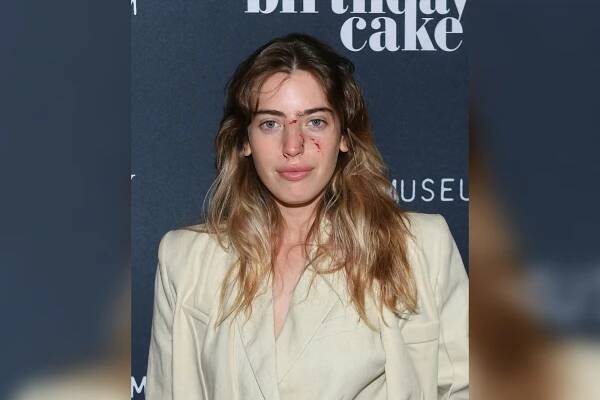 Ewan McGregor's daughter Clara's face bitten by dog before premiere