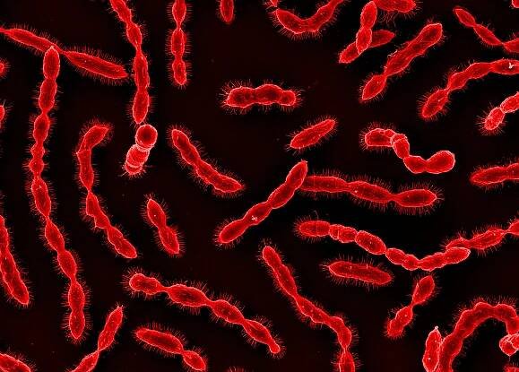 Elektronenmikroskopische Aufnahme von Streptococcus pneumoniae
