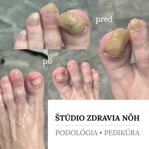 Naša práca - Štúdio zdravia nôhŠtúdio zdravia nôh