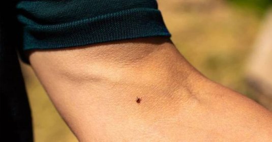 How to Recognize and Deal With a Tick Bite