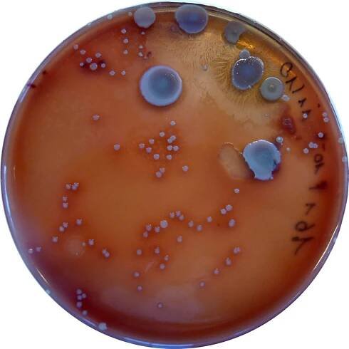 Underarm bacteria - Doctor Armpit